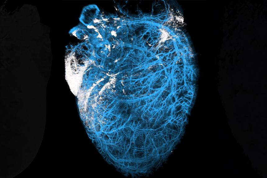 The parasite that causes Chagas disease can cause inflammation in the heart, as shown in white here in a mouse model. (Image courtesy of Fernando Sanchez)